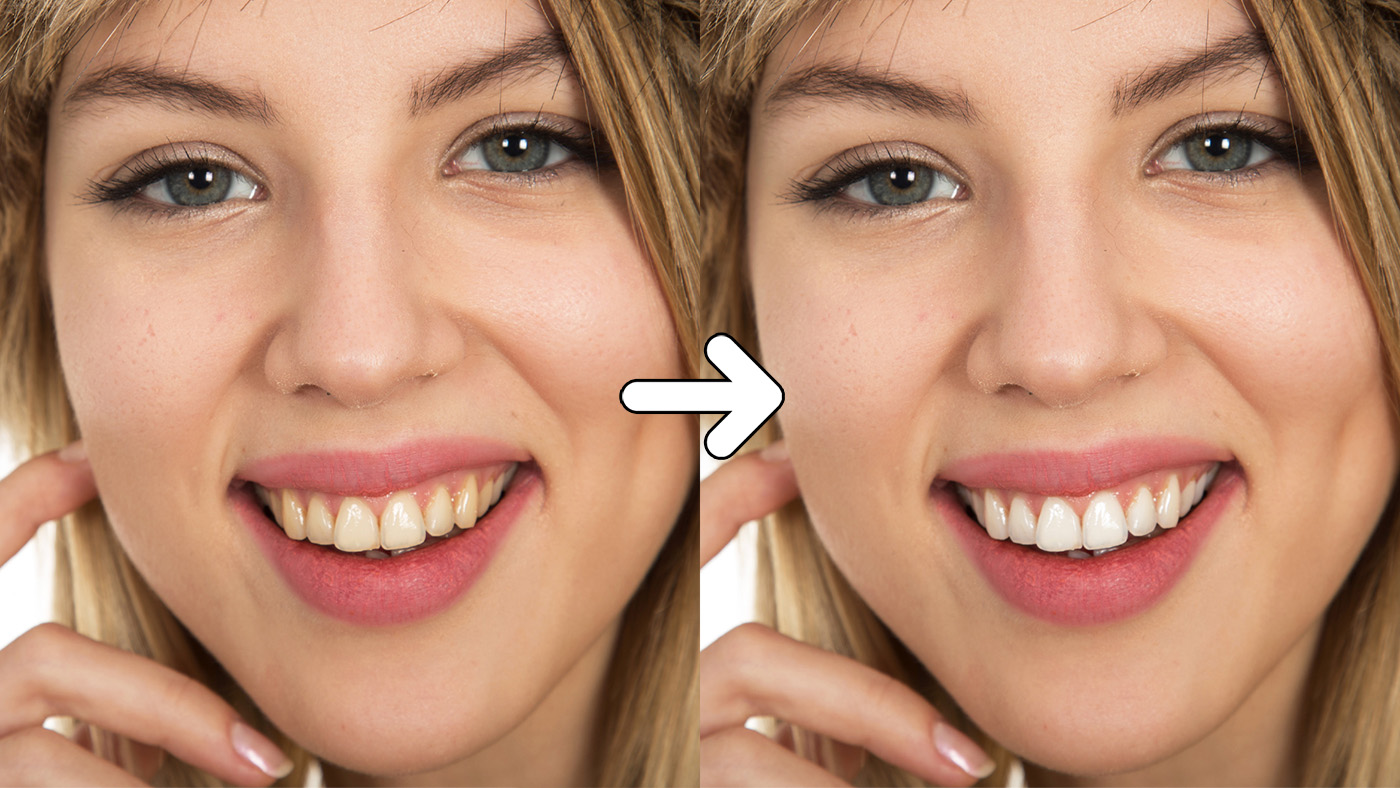 Tanden wit maken in Lightroom - Edit with Kim